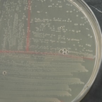 Catalase test