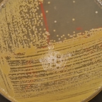 Catalase test