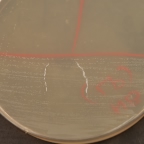 Catalase test
